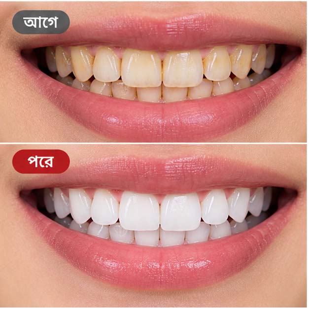 SIP-4 Ultra Probiotics Toothpaste - Image 2